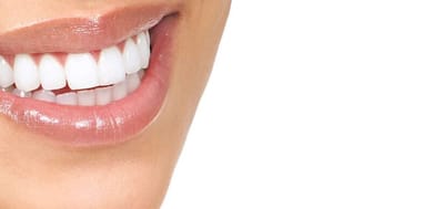 Is Teeth Whitening Effective for Tartar Stains?