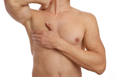 Is Gynecomastia Preventable With Lifestyle Changes?