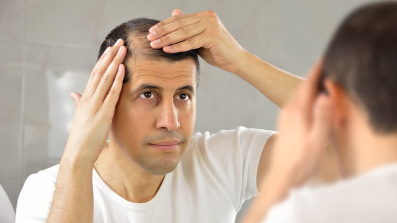 Is Finasteride Right for You? A Deep Dive into Hair Loss Treatment