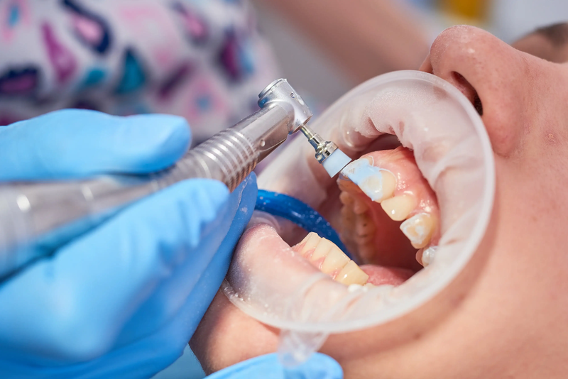 Clean Slate: How Teeth Cleaning Can Improve Your Oral Health