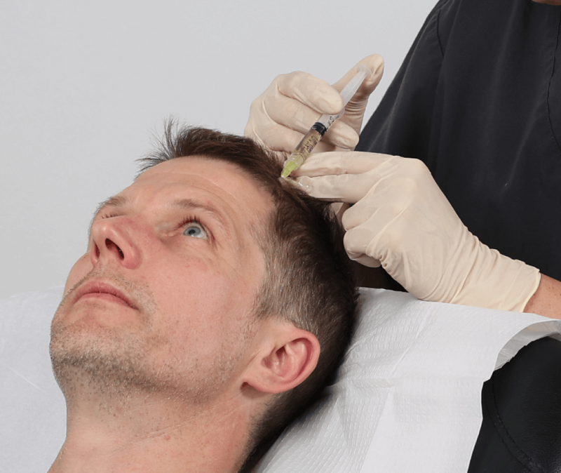 PRP Hair Treatment: A Breakthrough in Hair Restoration