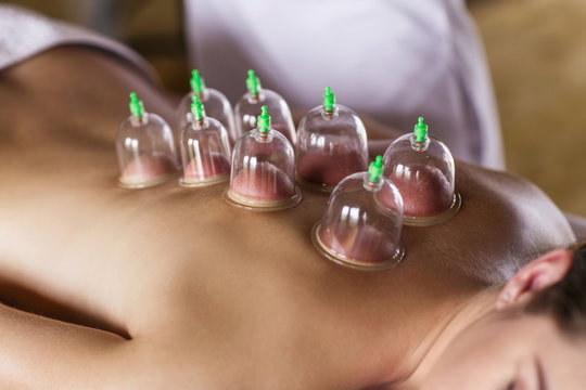 How Can Hijama Cupping Therapy Enhance Lung Health?