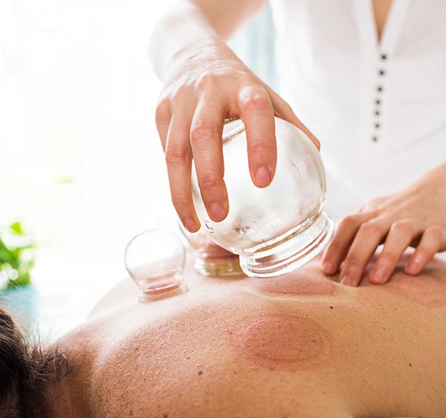 How Does Hijama Cupping Therapy Boost Overall Wellness?