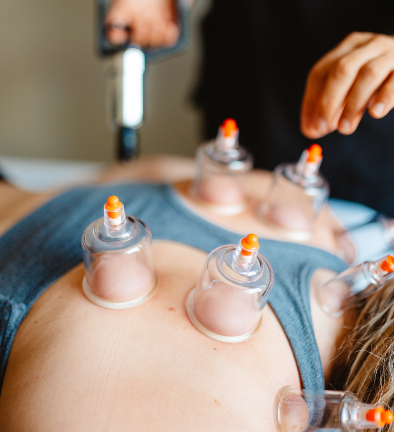 How Does Hijama Cupping Therapy Work on Muscles?