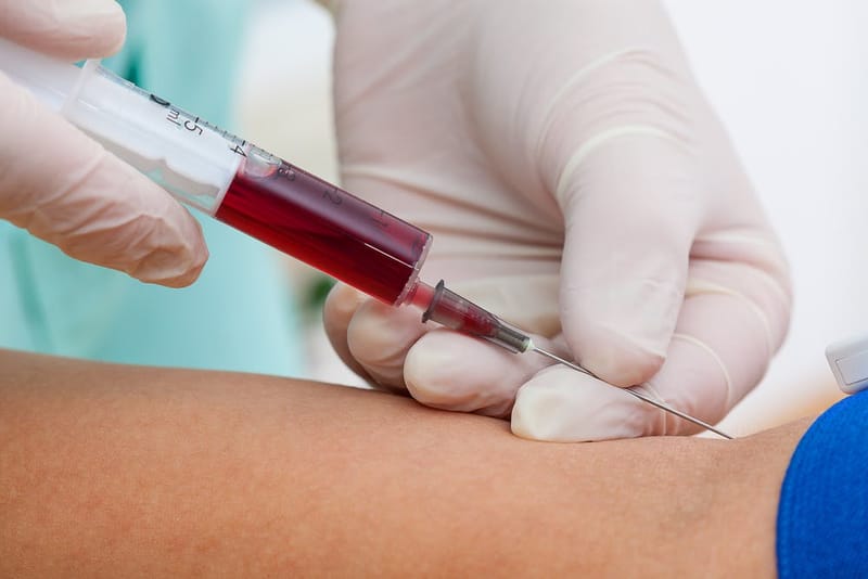 Personalized Blood Testing at Home: Track Your Health Easily