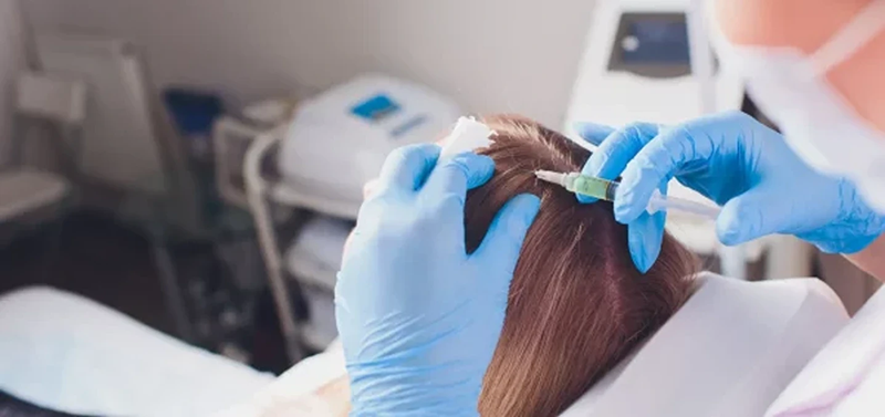 How PRP Therapy Can Help You Achieve Fuller, More Voluminous Hair