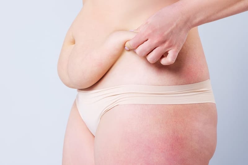 What You Should Know About Tummy Tuck Anesthesia