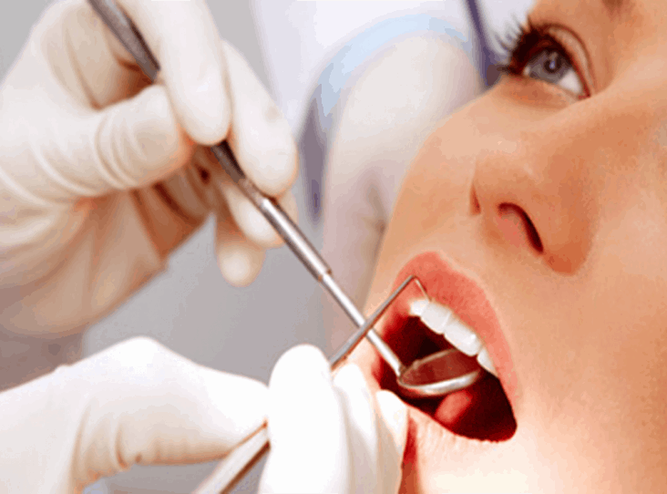 Teeth Whitening Strategies That Keep Your Smile Bright
