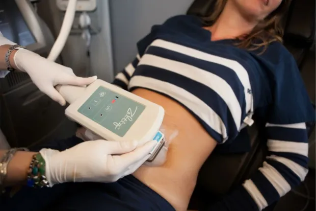 CoolSculpting Turns Body Goals into Reality with Ease