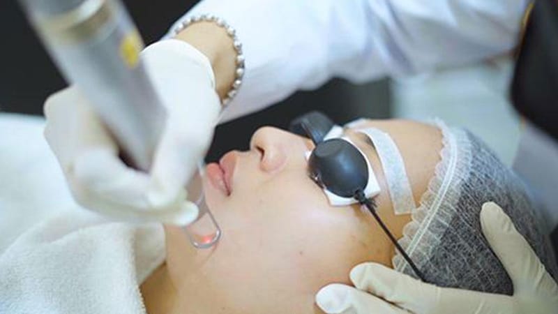 What Skin Problems Can Pico Laser Treatment Solve?