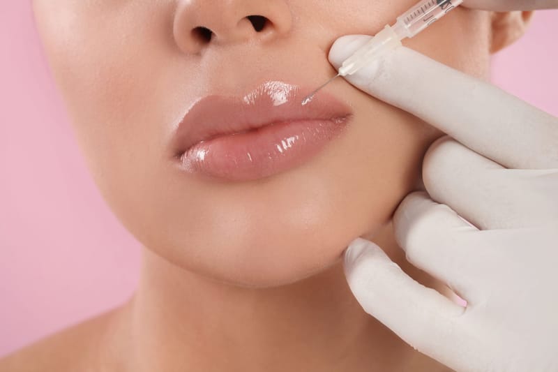 Lip Fillers: Can You Still Smile Naturally?