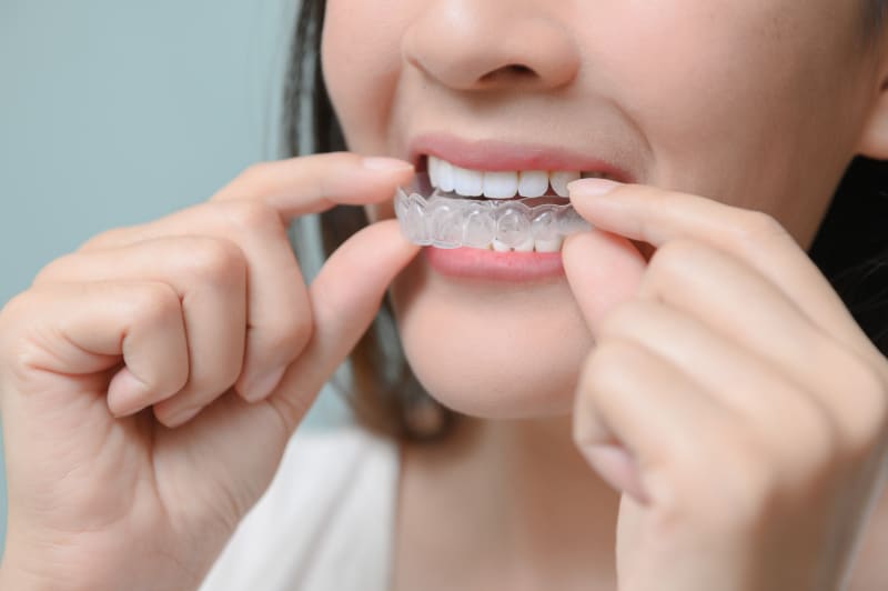 Tips to Adjust Faster to Invisalign Braces Treatment Aligners