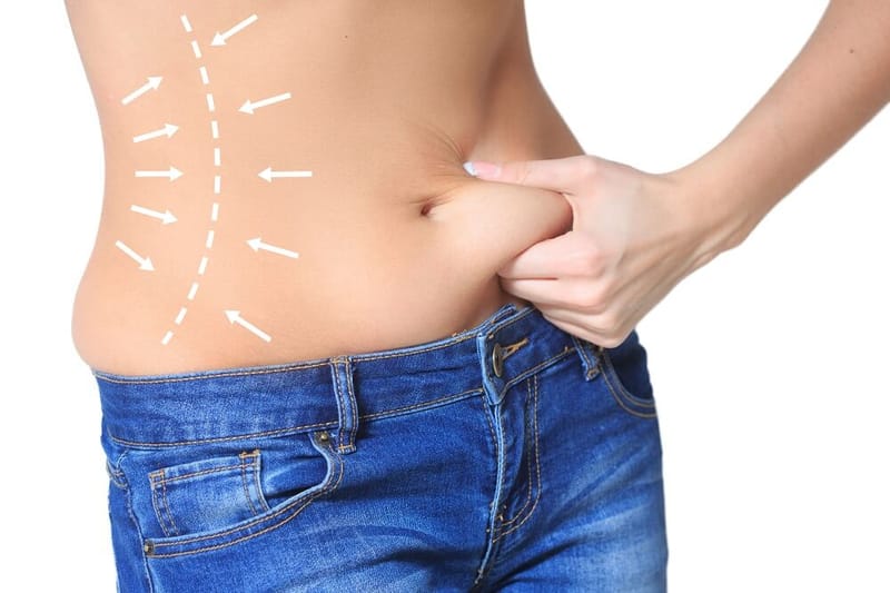 Is a Tummy Tuck Suitable for People With High BMI Levels?