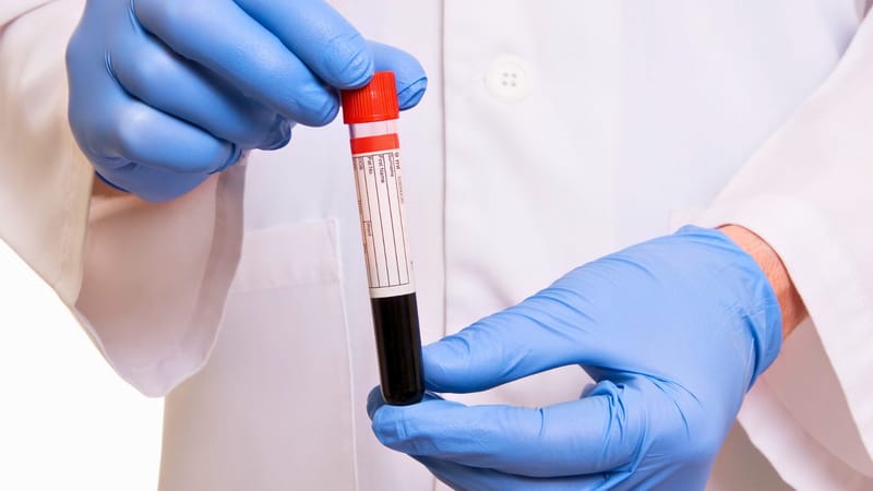 Can Symptoms Mislead You About Needing an STD Test?