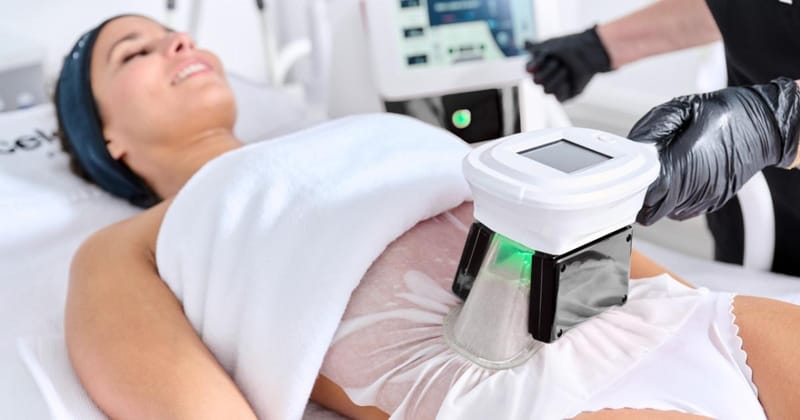 Can CoolSculpting Be Combined With Fitness for Best Results?