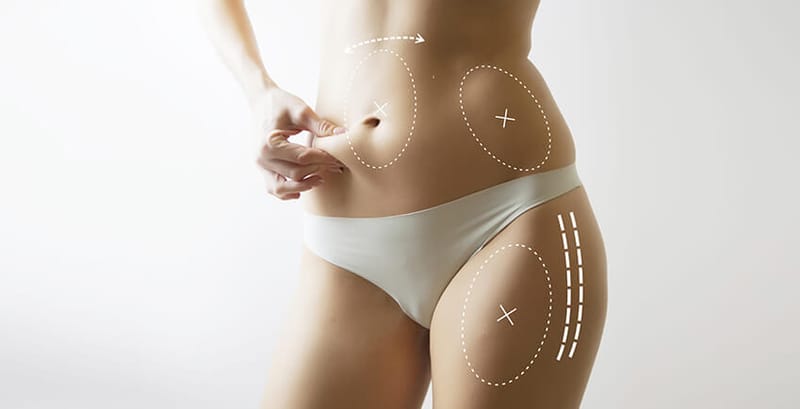 Does a Tummy Tuck Make the Waistline Look Smaller Too?