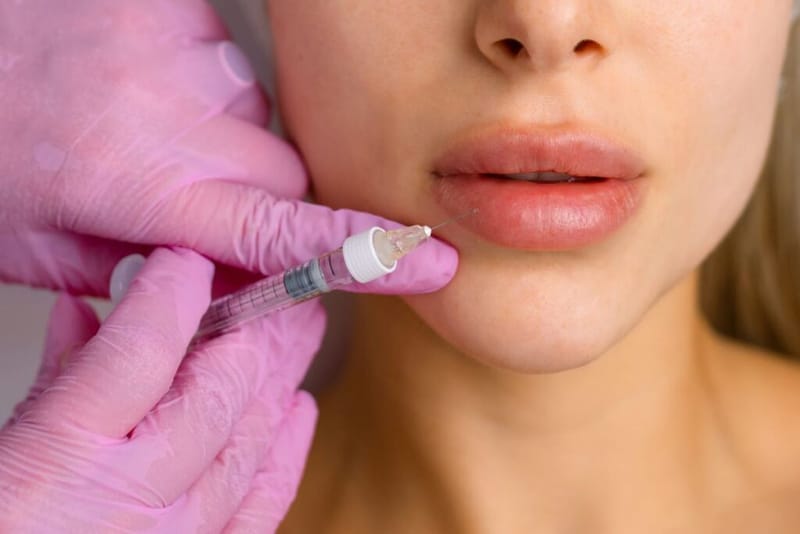 How Long Do Lip Fillers Injections Take to Settle