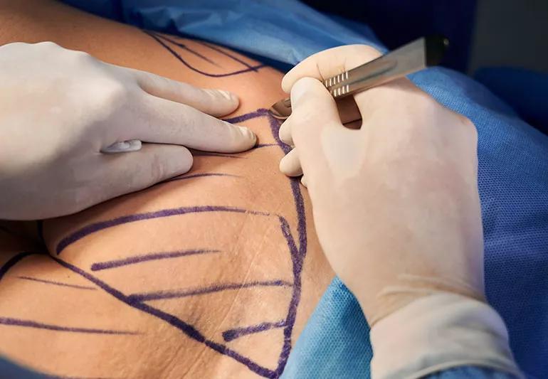How Bariatric Surgery Supports Mental and Physical Health