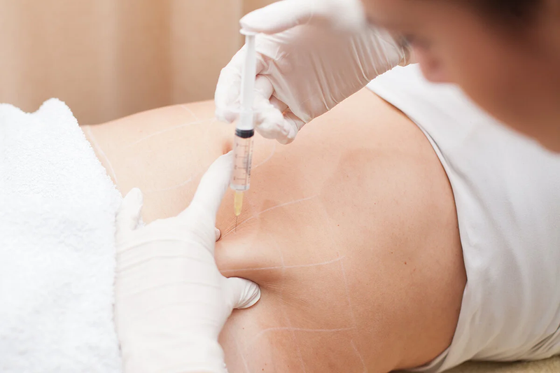 Fat Melting Injections: Ideal Areas for Treatment