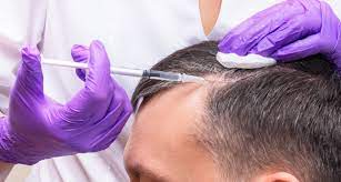 Is Platelet-Rich Plasma (PRP) Therapy Allowed in Islamic Law?