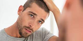 What Does Islam Say About Hair Transplants? Al-Azhar Weighs In