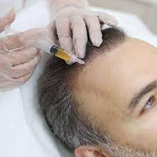 Is PRP Better Than Medication for Hair Loss in