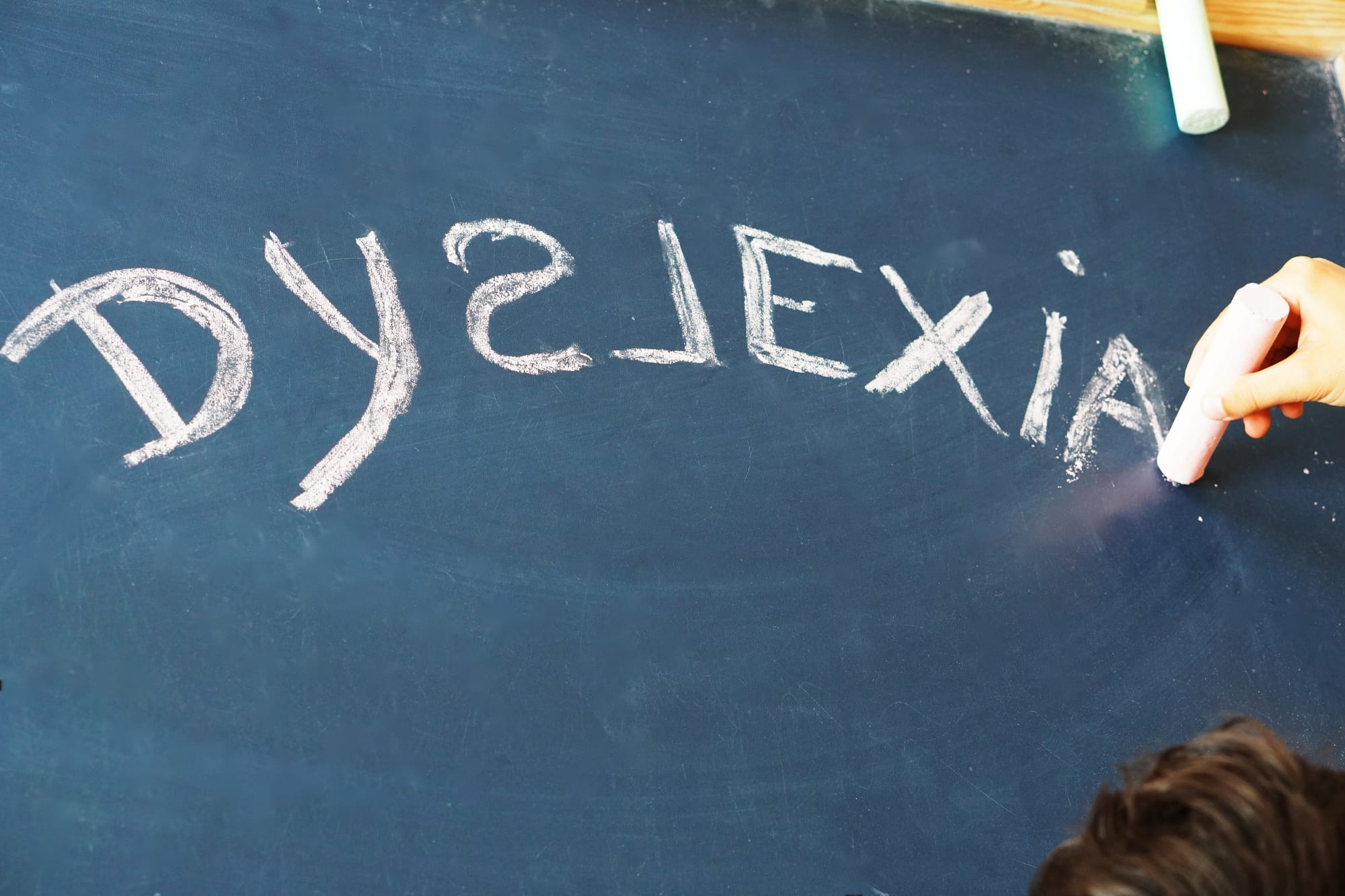 Inclusive Classroom Practices: Empowering Dyslexic Learners